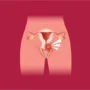 Benjolan Pada Vagina